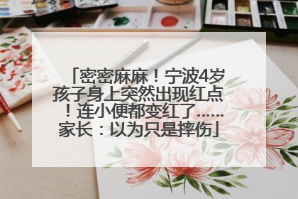密密麻麻！宁波4岁孩子身上突然出现红点！连小便都变红了……家长：以为只是摔伤